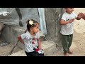 "حتى الثياب توجعها".. الفقاعة الجلدية تنهش جسد طفلة غزّية
