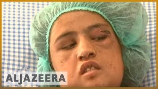 Afghan child bride tortured for six months Afghan child bride tortured for six months