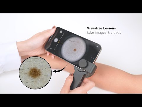 IBOOLO DE 3100 dermatoscope