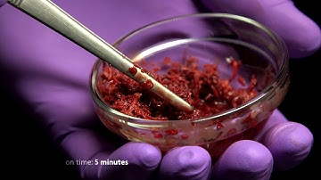 ReadiGRAFT BLX Fibers and Cancellous  68 60 064 mp4 mp4