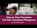 Step by Step Procedure: FUE Hair Transplant Philippines