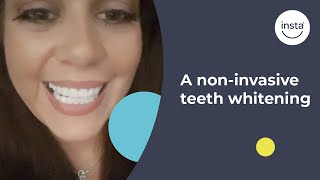 The Mother Of One Undergoing A Teeth Whitening Treatment At Home In Essex