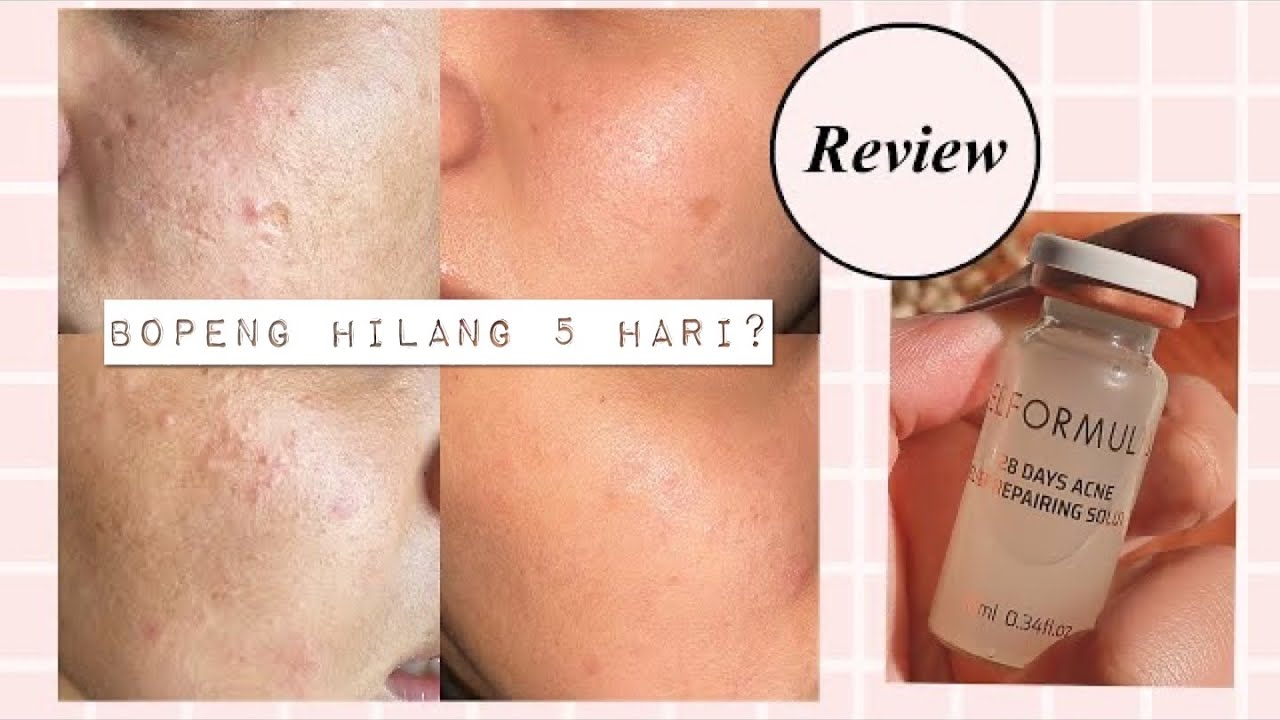 elformula acne serum