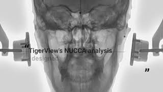 NUCCA Tools - Tigerview Software