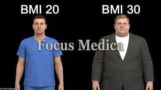 Body Mass Index