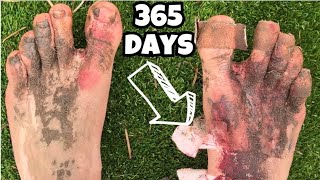 365 DAYS in Barefoot Shoes.... My Feet Are Broken, The TRUTH Why I Hate Them ! screenshot 3