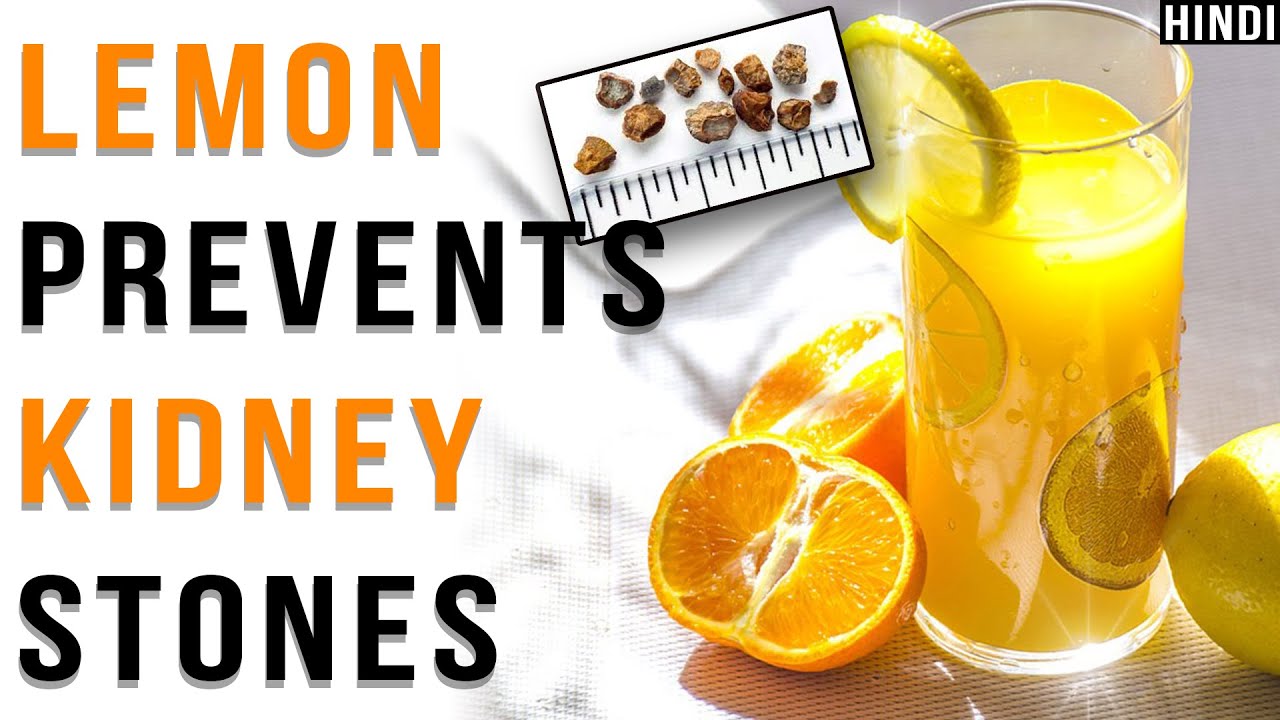 Eliminate Kidney Stones With Lemons In Hindi YouTube