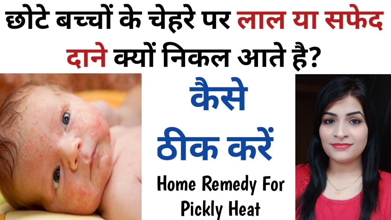 Chhote Baccho ke Face Par Lal Dane Kyo Nikalte hai l Bachcho ki Skin Allergy Kaise Theek Kare