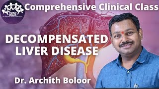 DECOMPENSATED LIVER DISEASE clinical case presentation