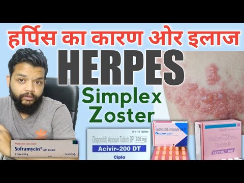 हर्पीस का कारण ओर इलाज / Herpes Simplex & Zoster Treatment In Hindi