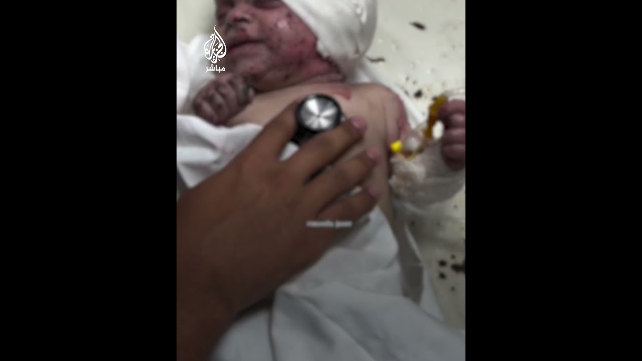 إصابة طفلة رضيعة بجروح جراء استهداف الاحتلال خيمة تؤوي نازحين وسط قطاع غزة