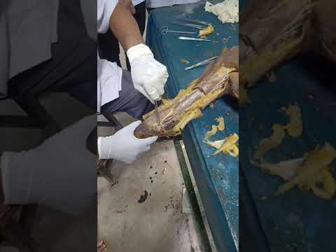 Dissection of front of the arm & cubital fossa camera iphone 8 plus apk
