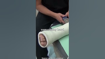 Reason Why A Cast Saw Doesn