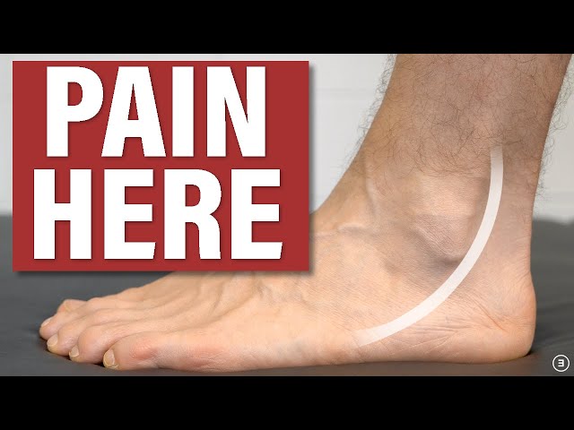 Heel Pain After Running: Causes, Treatment, Prevention