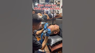 Xăm chân tóc khắc phục hói đầu #cấytóc #hóiđầu #xamchantoc #smp