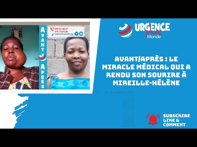 Avant/Après : Le miracle médical qui a rendu son sourire à Mireille-Hélène