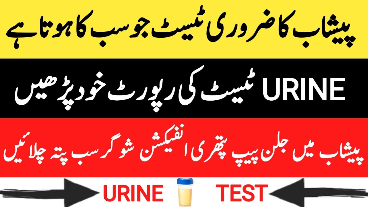 Urine Test Report Kaise Dekhe - Urine Routine Examination - Urine Test In Urdu - Urine Test In Hindi