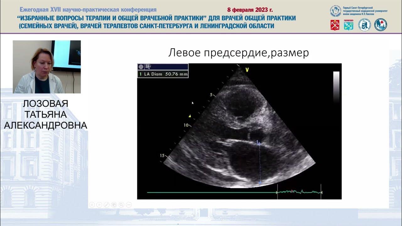 Клинический случай по пациенту. Клинические случаи в неврологии. Редкий клинический случай. Редкий клинический случай. Узи трихобезоар в желудке.