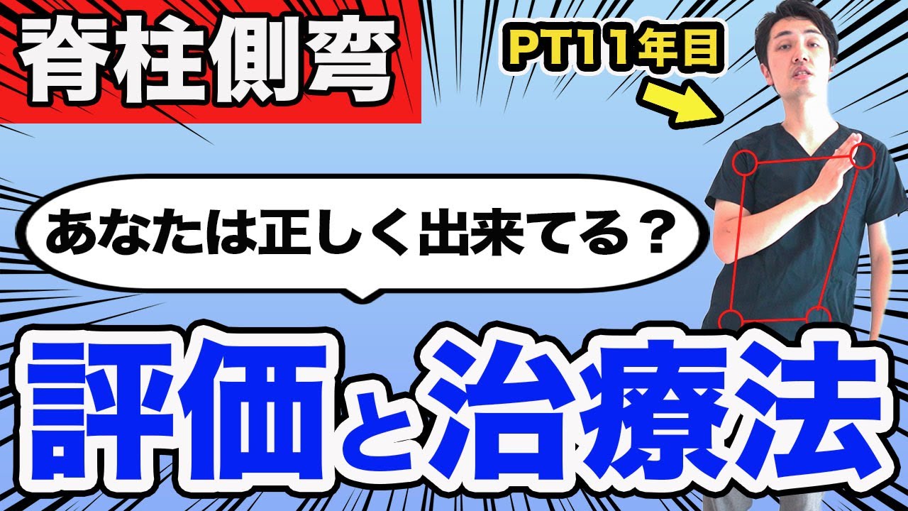 【脊柱側弯の評価】この考え方を知るだけで、明日の臨床が変わります。(理学療法士)