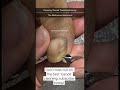 Best Toenail Cleaning