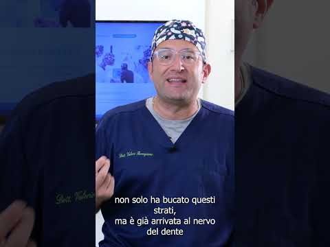 Video: Come controllare la carie nei denti?