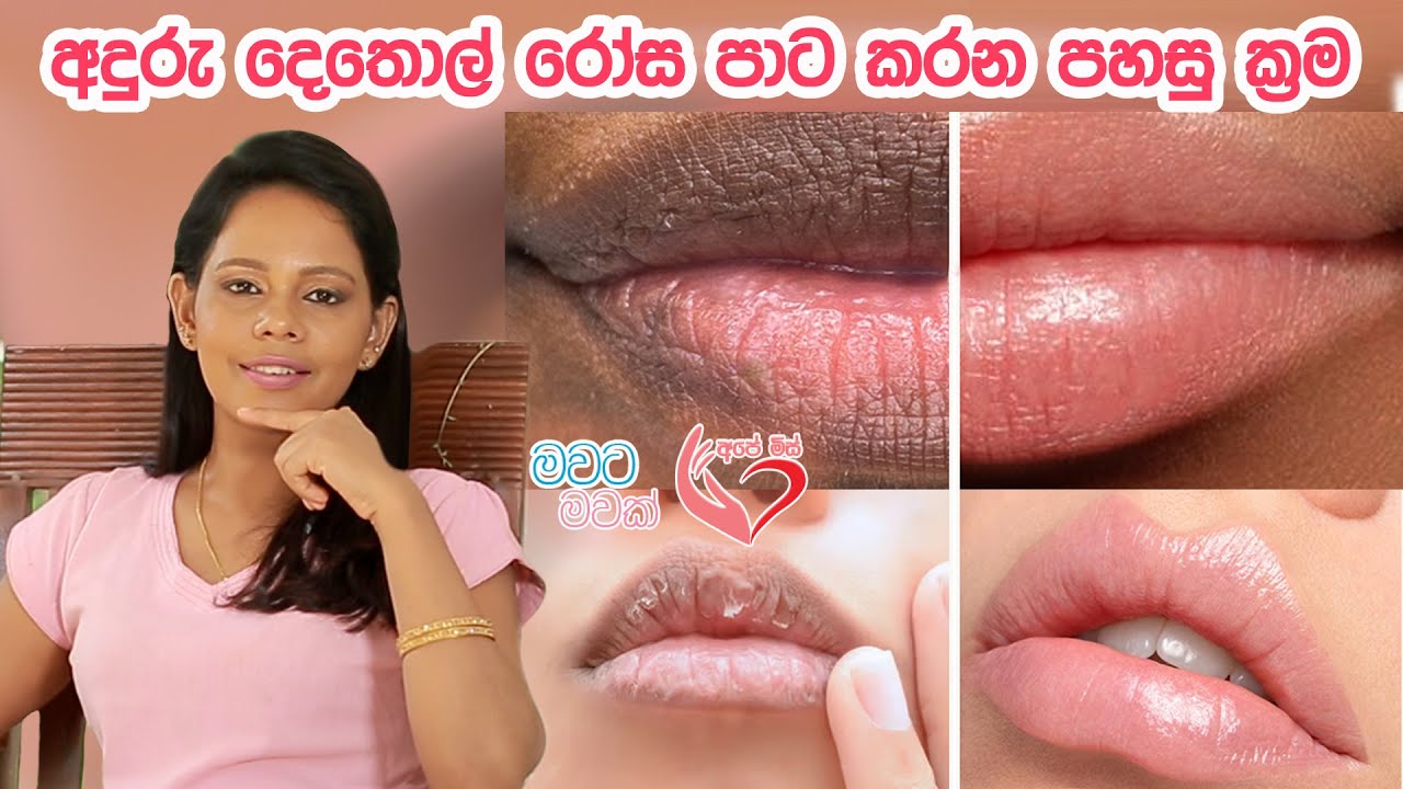 අදුරු දෙතොල් රෝස පාට කරන රහස The secret of Rosy lips|Ape Miss-අපේ මිස්|Shyamalee Pathirge