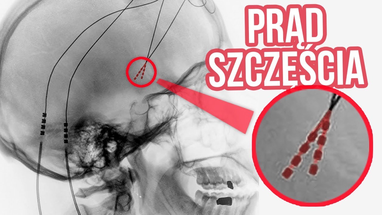 Czy można przedawkować szczęście? kacper wielusiński gitarzysta
