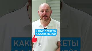 🦷 Какие брекеты лучше и самые эффективные? 🦷 Прикус и выравнивание зубов