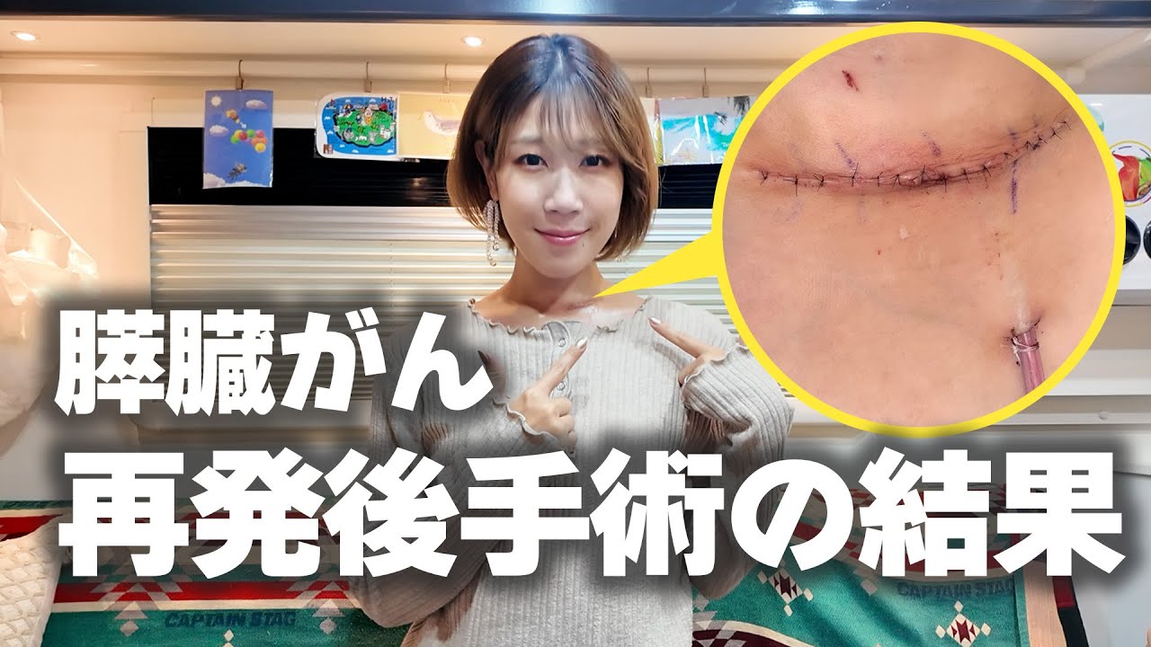 膵臓がん再発後の手術が終わりました