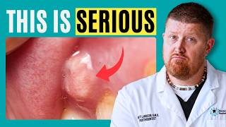 Can a Tooth Infection Become Dangerous? 10 Dental Questions Answered