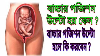 বাচ্চার পজিশন উল্টো হলে কি করবেন | গর্ভে বাচ্চার অবস্থান | Reverse Baby Position In Womb -TipsBangla