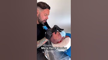 Scalp micropigmentation First session results #scalpmicropigmentation #smp #hairlosstreatment