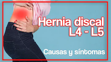 ¿Cuáles son los síntomas de la hernia discal l3 L4?