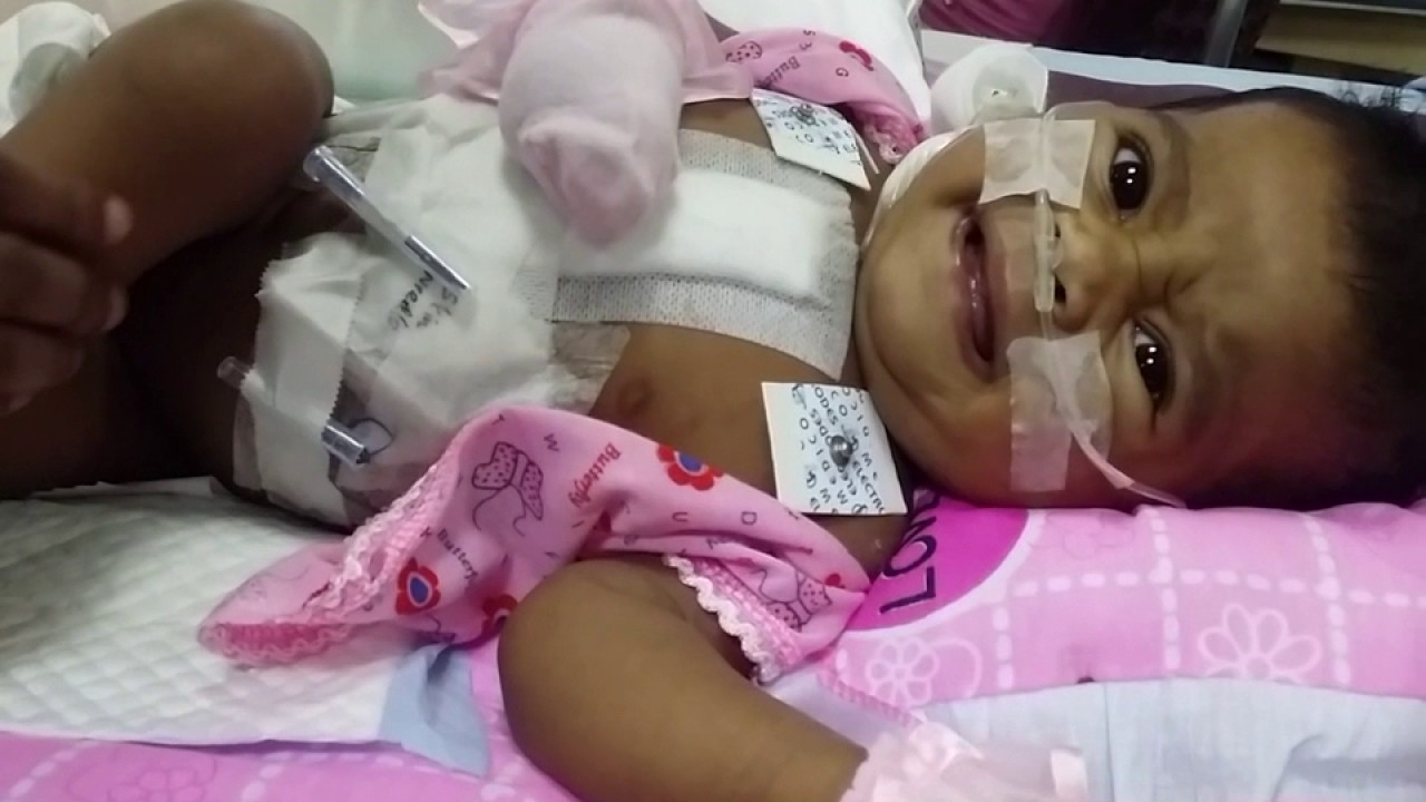 Save Life Sri Lanka Dringende Herz Op Fur Baby Aleena Sie Lebt Erstes Video Nach Der Op Youtube