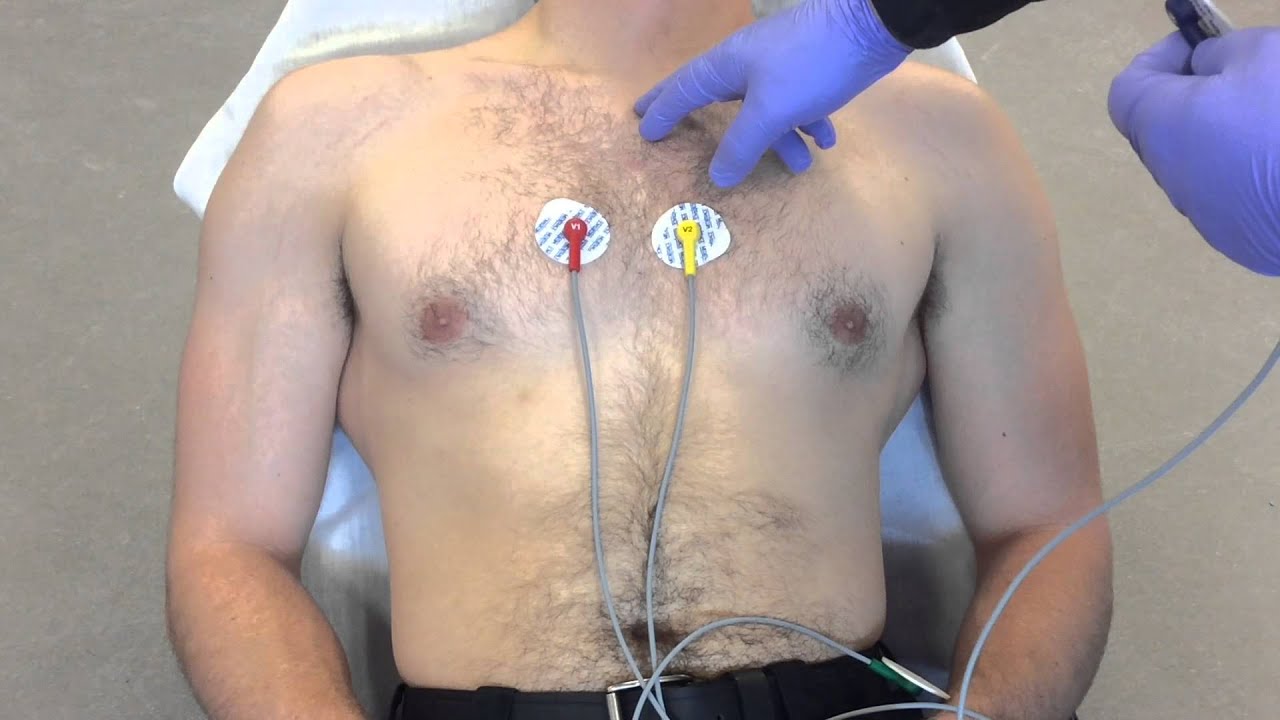 12 lead ecg placement mnemonic