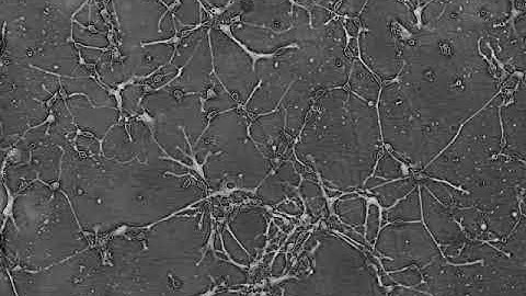 Neurite network formation