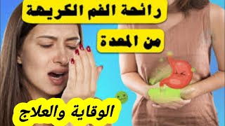 هل تعانى من رائحة فم كريهة و تشقق الشفتين ؟ _ طرق العلاج  _ و نصائح هامة لوقاية الأسنان من الضرر