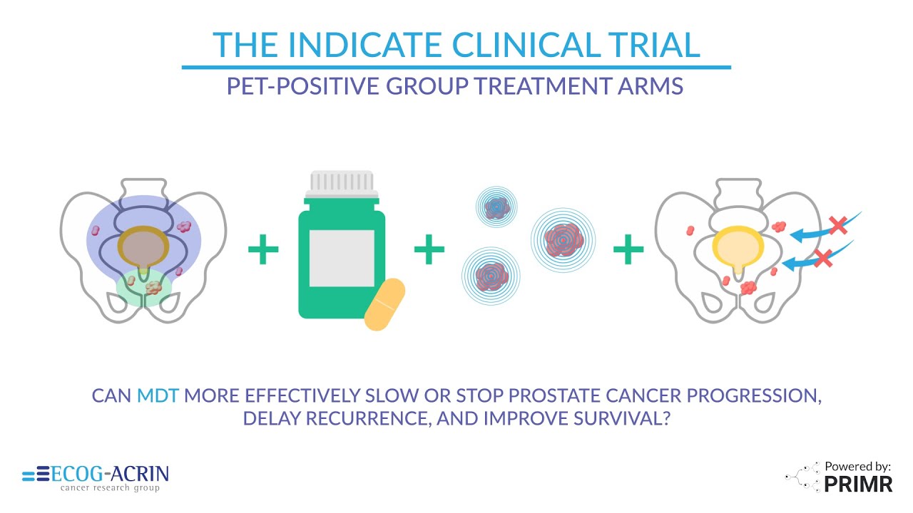 Prostate Cancer Clinical Trial: INDICATE (Part 3 of 3) - YouTube