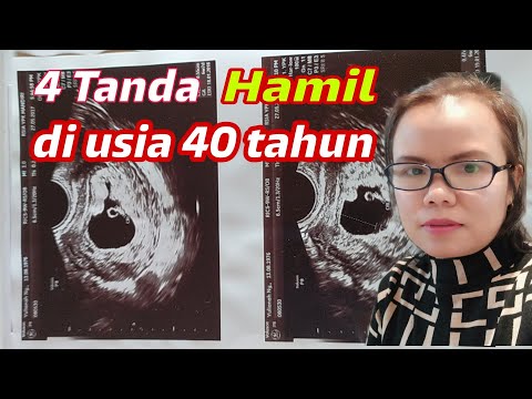 4 TANDA HAMIL DI USIA 40 TAHUN || TERNYATA BEGINI RASANYA vlog7