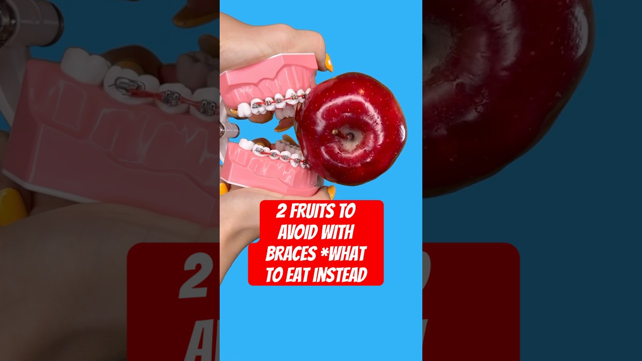 2 FRUITS TO AVOID WITH BRACES *what to eat instead 