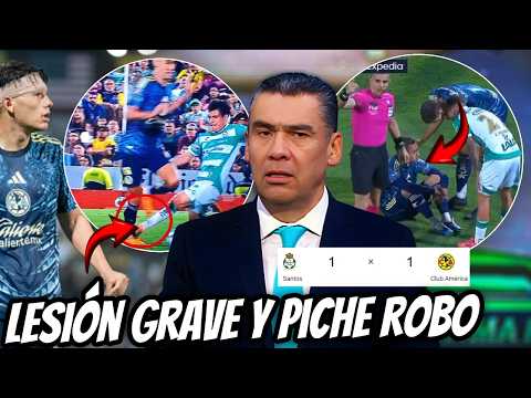 ¡ADIÓS AL TORNEO😭¡AMÉRICA PIERDE A SU JUGADOR POR LESIÓN TODA LA TEMPORADA!
