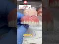 Maxillary Denture finished #dentist#parati#shorts#viral#fypシ#pink#acrylic#dentalprosthesis#reels