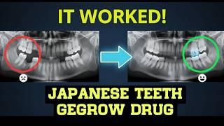 From Ferrets to Humans Inside Trials of Japan's Tooth Regrowth Drug | Medical Miracle