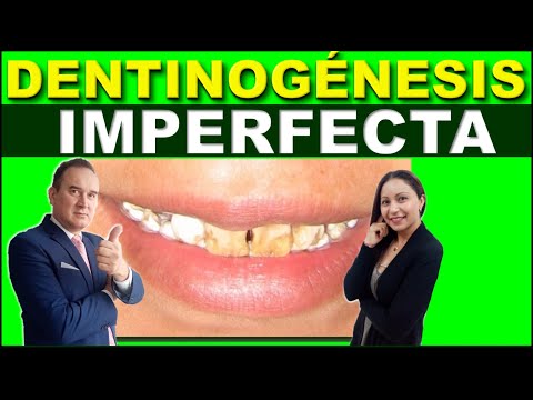 DENTINOGENESIS IMPERFECTA / UDVIKLINGSANOMALI I DENTALSTRUKTUR