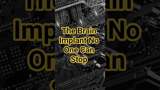 The Brain Implant No One Can Stop