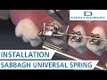 SUS installation - Sabbagh Universal Spring