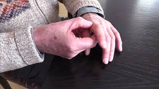 Zelfbehandeling Van Pijnklachten En Stijfheid Vingers