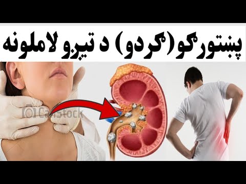 د ګردو (پښتورګو) تیږو لاملونه او ځان ساتلو طریقې