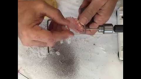 TCS Quick Tip 13 - Finishing A Flexible Partial Part 5