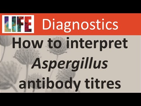 How to interpret Aspergillus antibody (IgG) titres for chronic aspergillosis